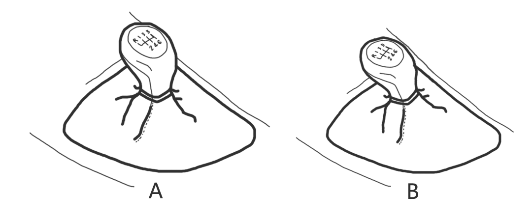 10张图判断你是不是老司机